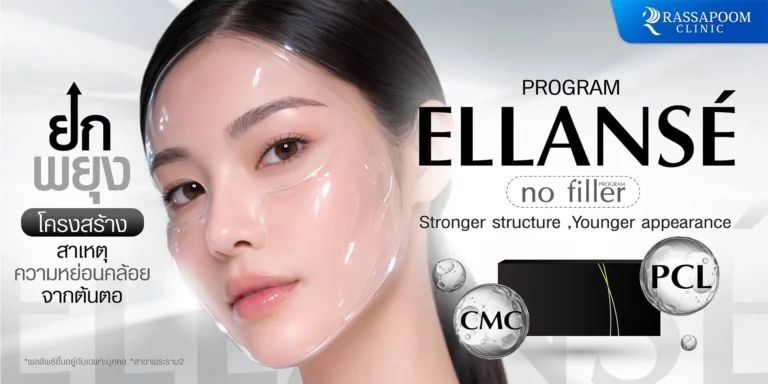 ปรับโครงสร้างใบหน้าด้วย โปรแกรม ELLANSE ให้นวลเนียน กระชับ และลดอาการบวมหลังการทำเติมได้ดี.