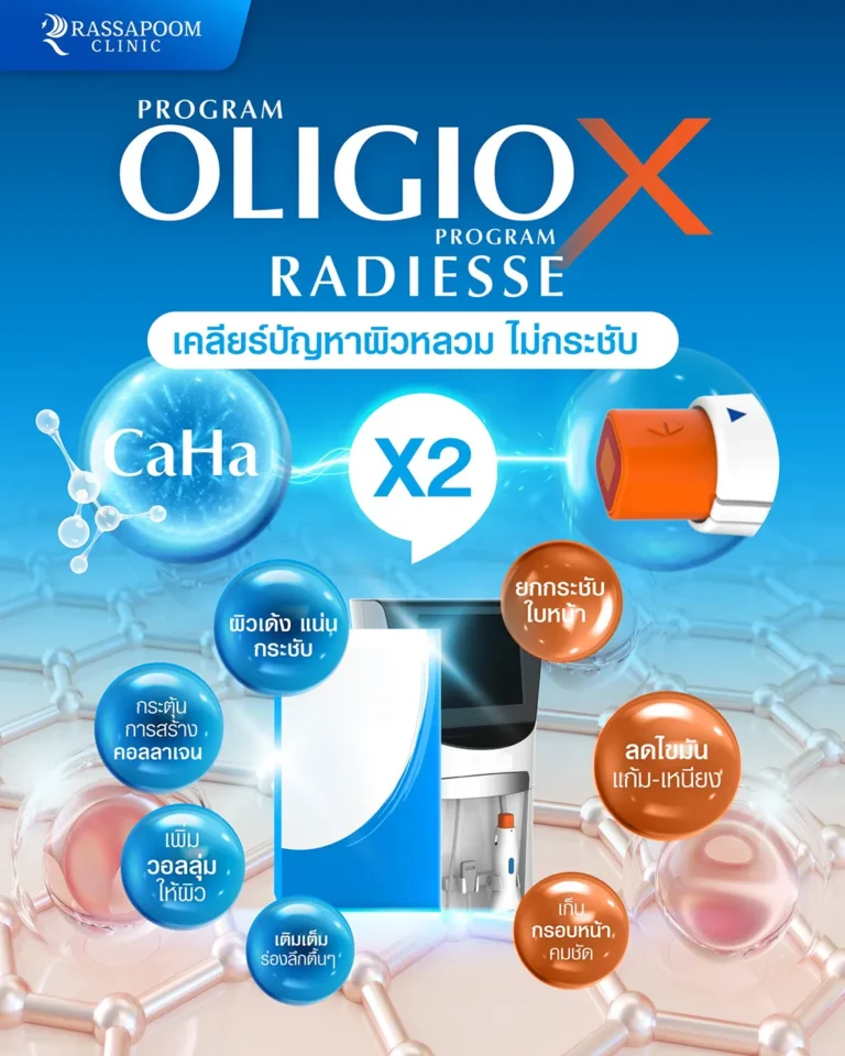 โปรแกรม #OligioX โปรแกรม #Radiesse เคลียร์ผิวหลวม ไม่กระชับ x2