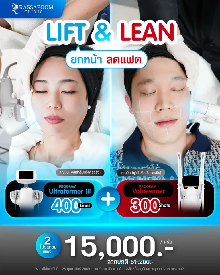 ยกหน้า ลดแฟต