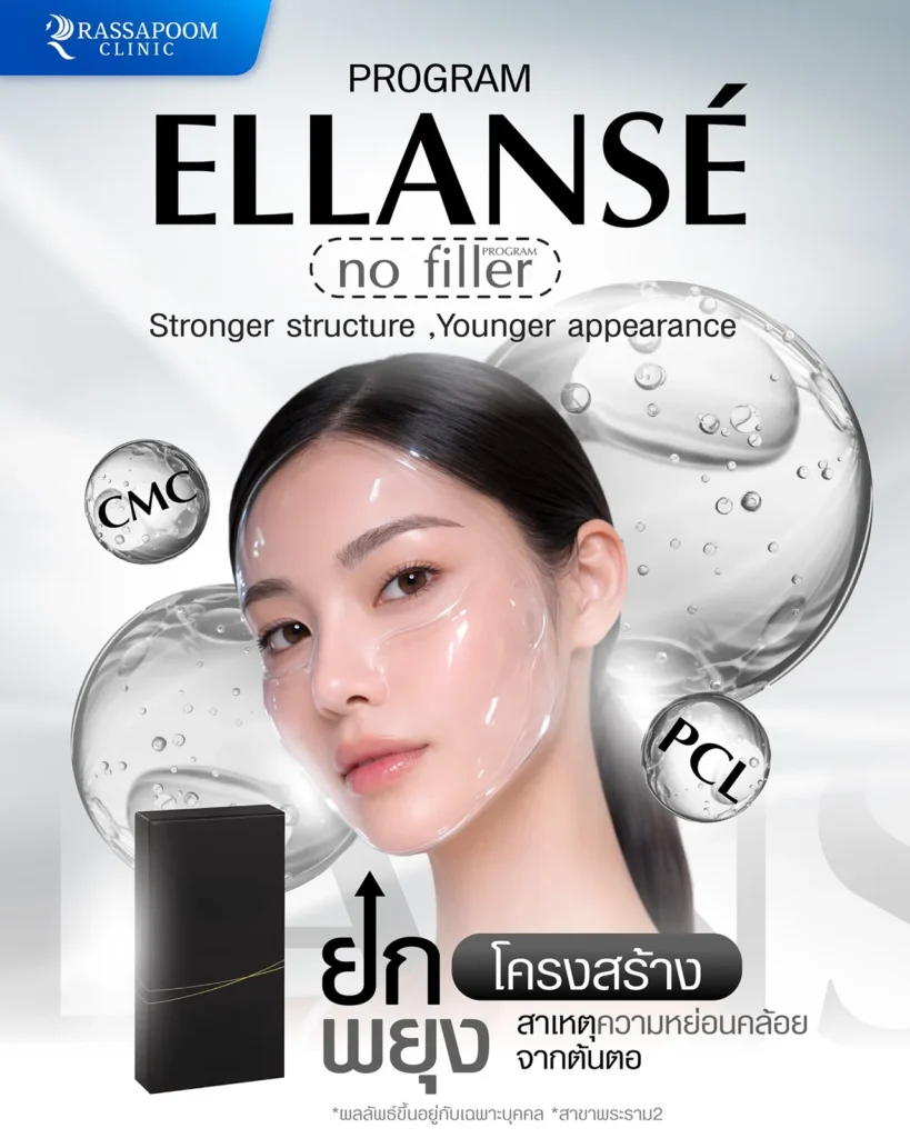ellanse ยกกระชับใบหน้า เติมเต็มร่องลึก