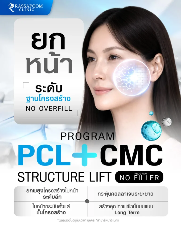 โปรแกรม PCL + CMC STRUCTURE LIFT ยกกระชับใบหน้า เติมเต็มร่องลึก
