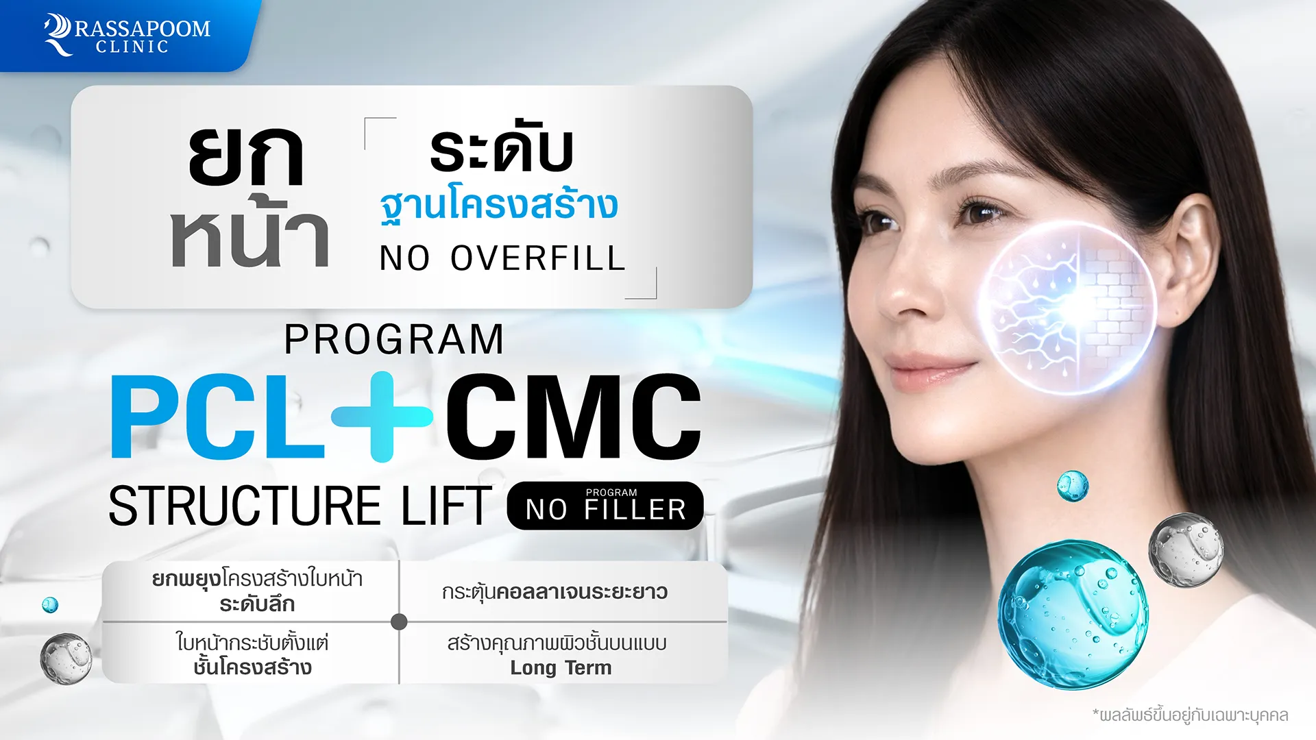 โปรแกรม PCL + CMC STRUCTURE LIFT ยกกระชับใบหน้า เติมเต็มร่องลึก