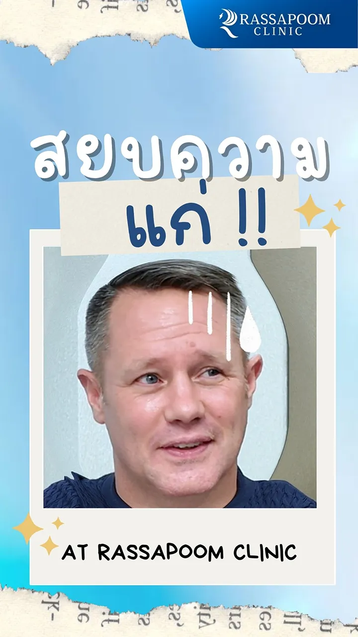 ลดริ้วรอย ร่องลึก ใบหน้าตกหย่อน