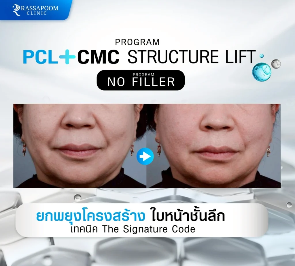 ผลลัพธ์หลังการทำ pcl+cmc