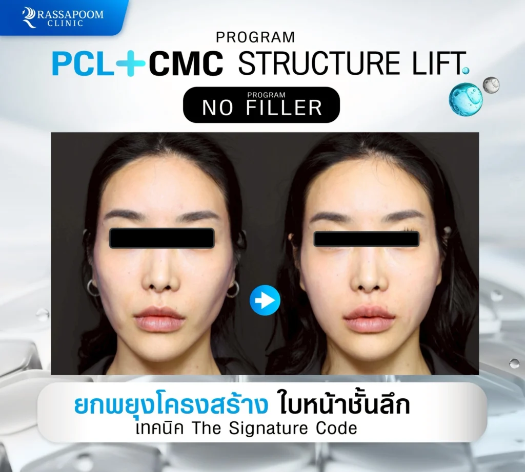 ผลลัพธ์หลังการทำ pcl+cmc