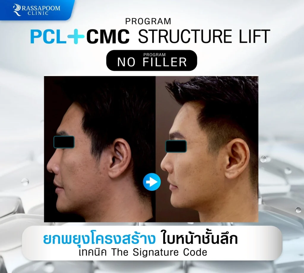ผลลัพธ์หลังการทำ pcl+cmc