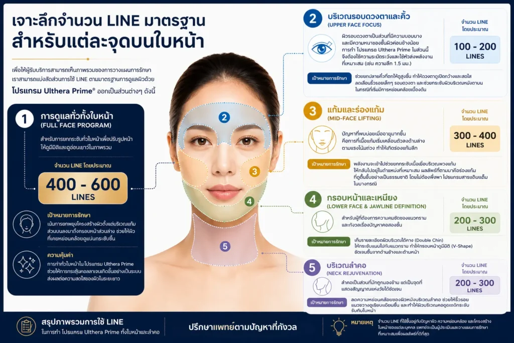 จำนวนที่ทำ Ulthera Prime บนใบหน้าแต่ละจุด