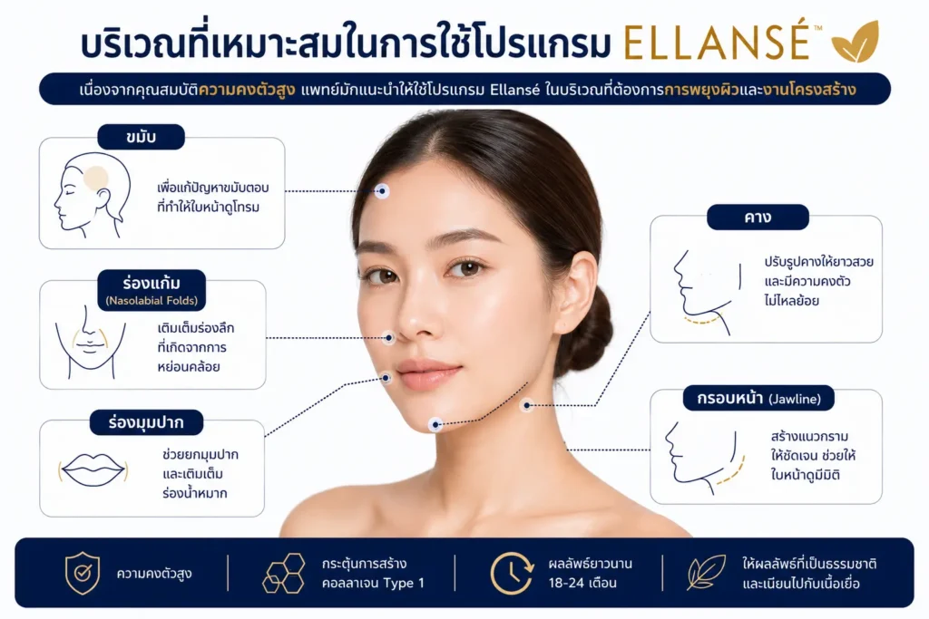 บริเวณที่ฉีด Ellanse Filler