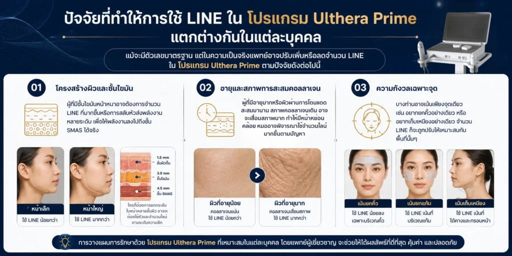 ปัจจัยที่ทำให้การใช้ Line ใน โปรแกรม Ulthera Prime แตกต่างกันในแต่ละบุคคล