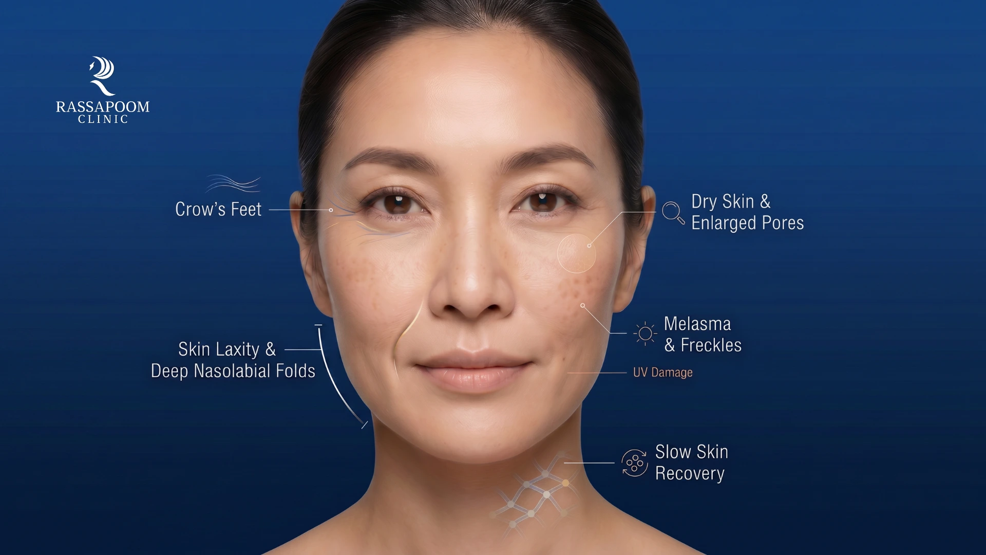 หน้าแก่ก่อนวัยมีสัญญาณอะไรบ้าง เช็กลิสต์และวิธีป้องกันด่วน!