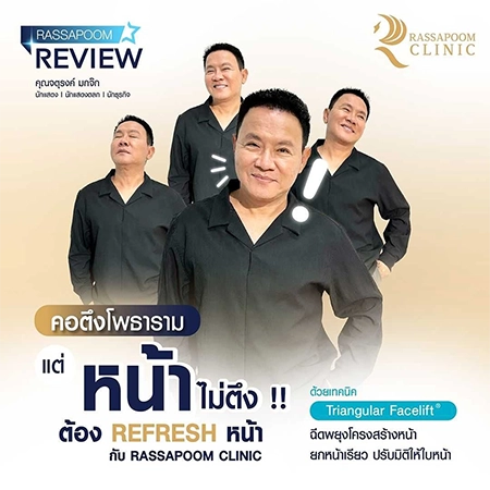 Triangular Face Lift ยกหน้าเรียว พยุงโครงหน้า (ลุงรงค์)