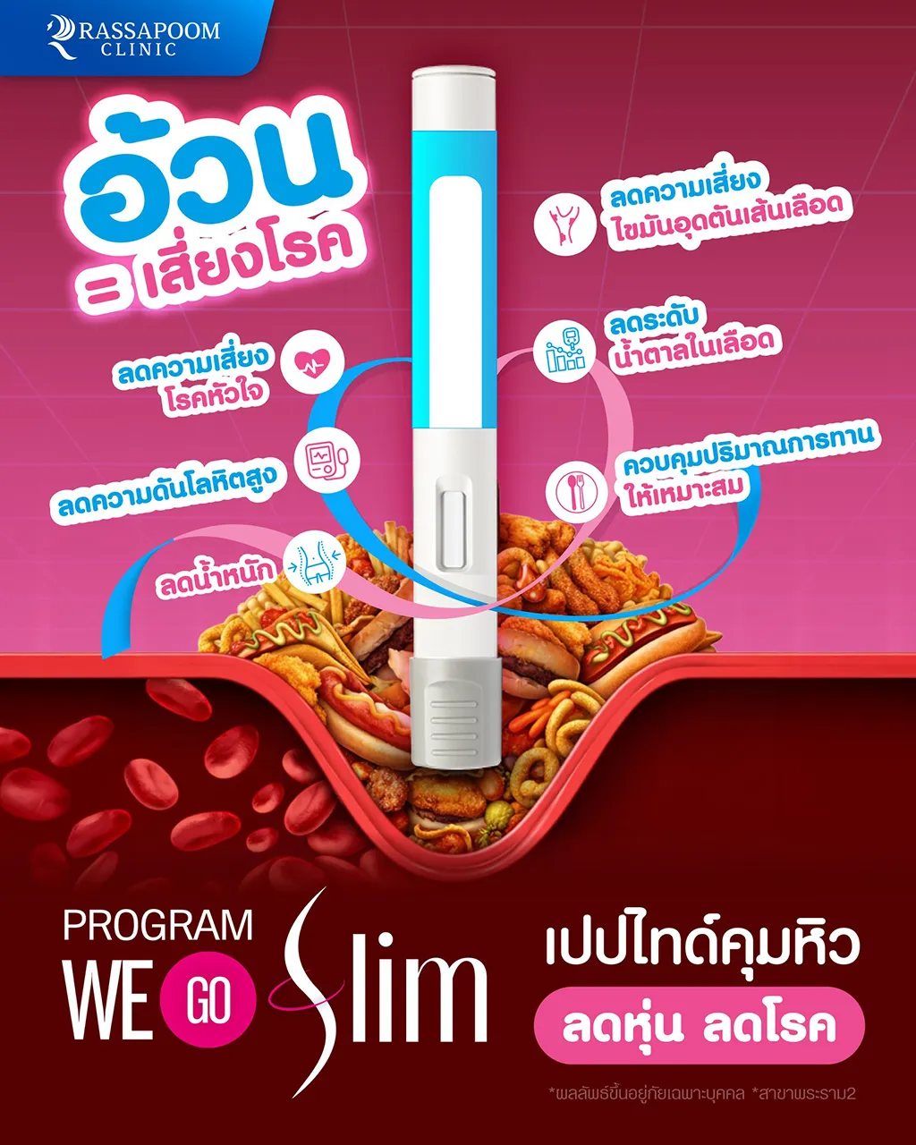 อ้วน = เสี่ยงโรค
