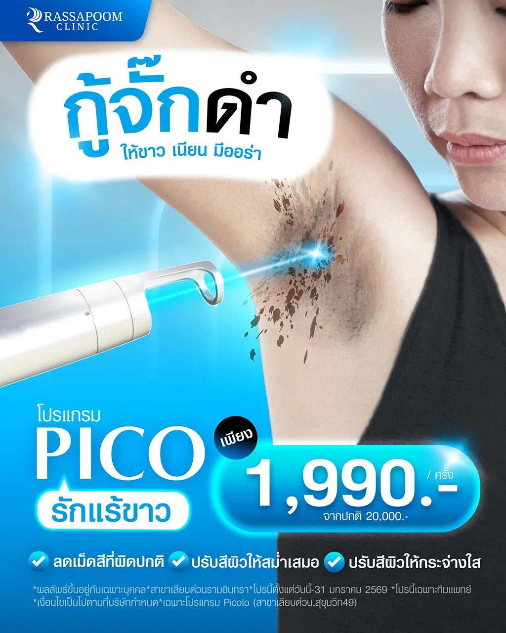 กู้จั๊กดำ ให้ขาวเนียนมีออร่าด้วย PICO LASER