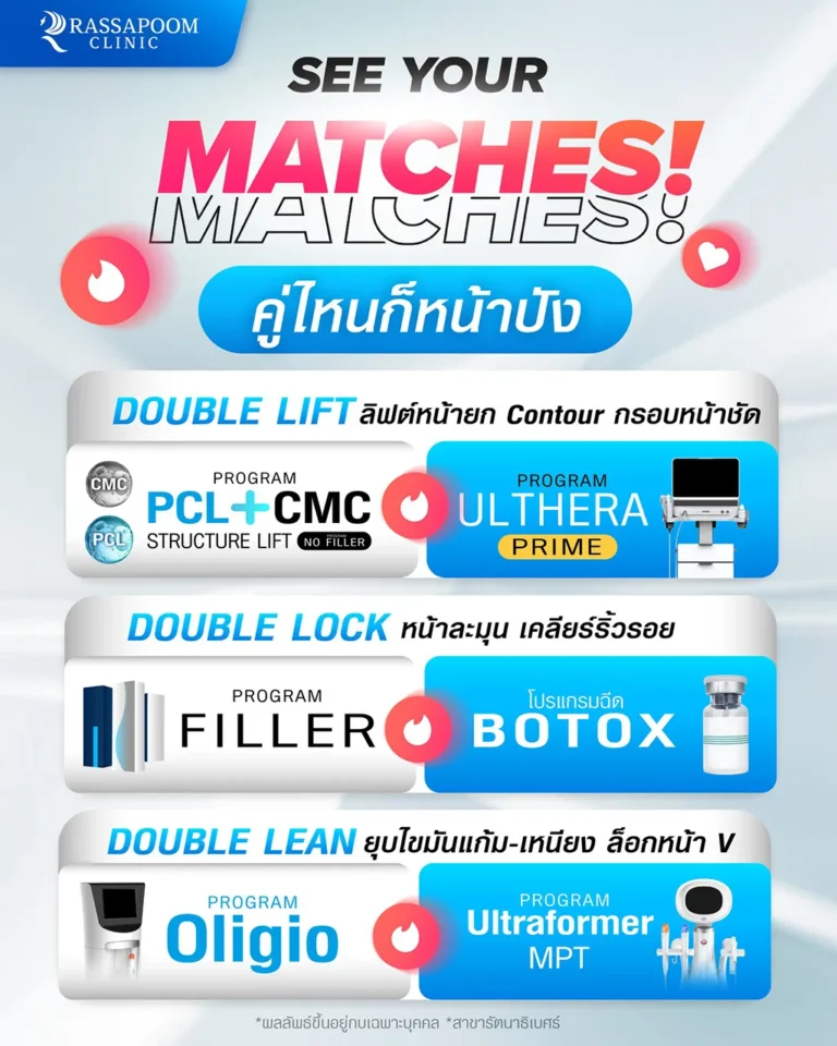 SEE YOUR MATCHES ไม่ว่าแมทซ์คู่ไหน หน้าก็ปัง