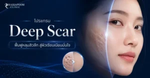 โปรแกรม Deep Scar