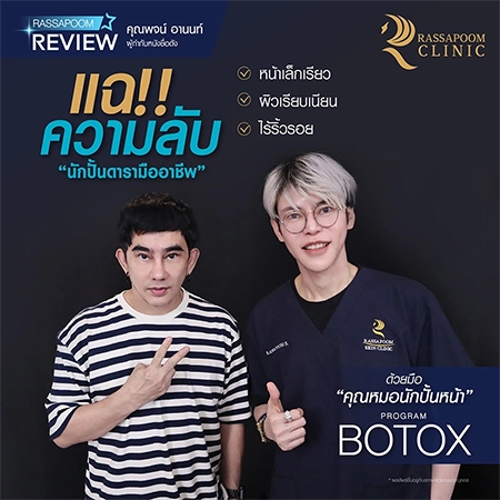 ฉีดโบลดกราม ลดโหนกแก้ม หน้าเรียวเล็ก (คุณพจน์ อานนท์)