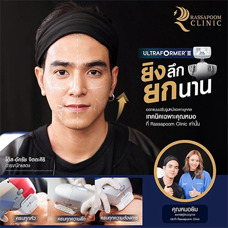 Ultraformer III สร้างคอลลาเจนในชั้นผิว ยกกระชับผิวหน้า (คุณโต๊ส อัครัช จิตตะศิริ)