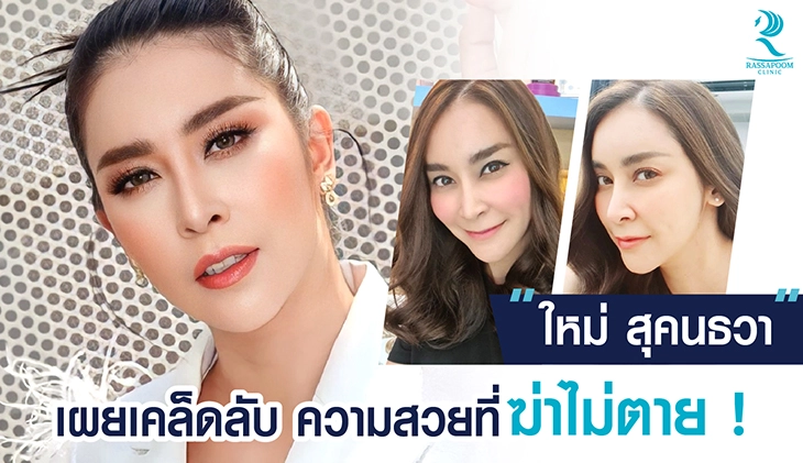 เคลียร์สิวรักษาสิวด้วยโปรแกรม Super Skin Laser (คุณใหม่ สุคนธวา)