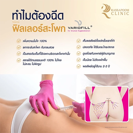 Buttock filler injection