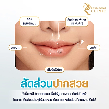 Lip filler injection