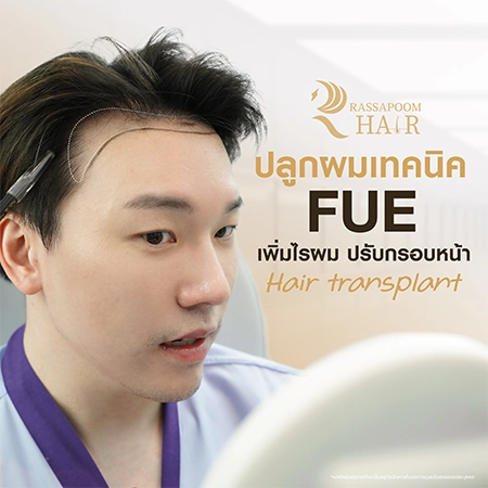 โปรแกรมปลูกผมด้วยเทคนิค FUE แก้ไขปัญหาหน้าผากกว้าง (คุณหมอเคน)