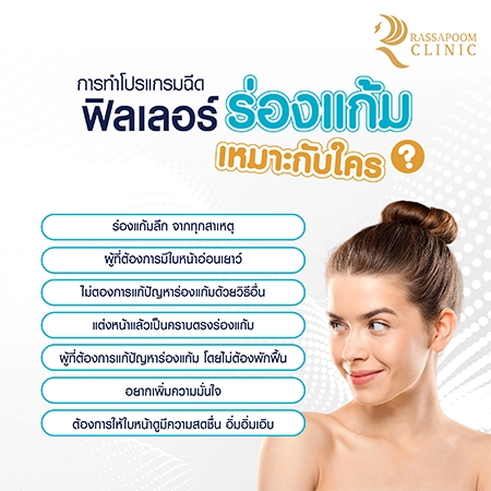 Cheek filler injections