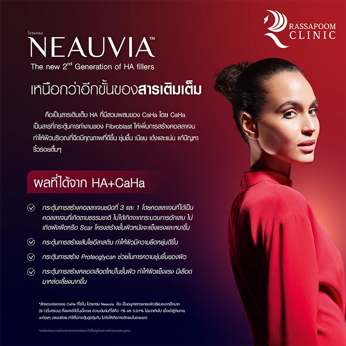 Neauvia filler