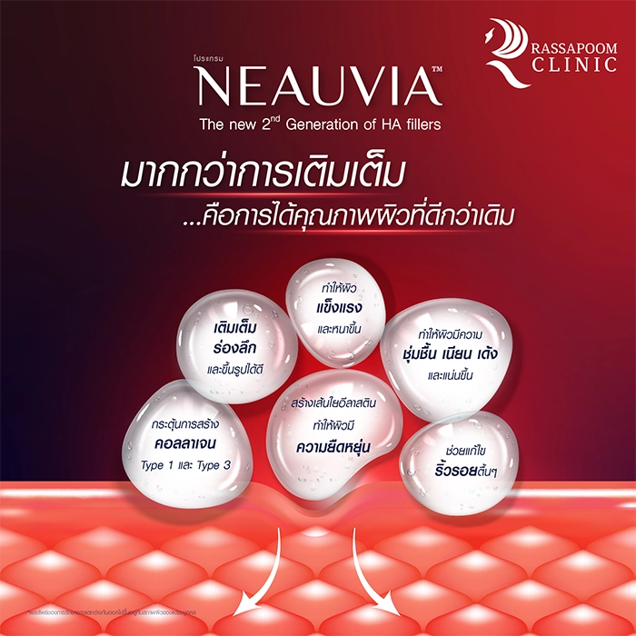Neauvia filler