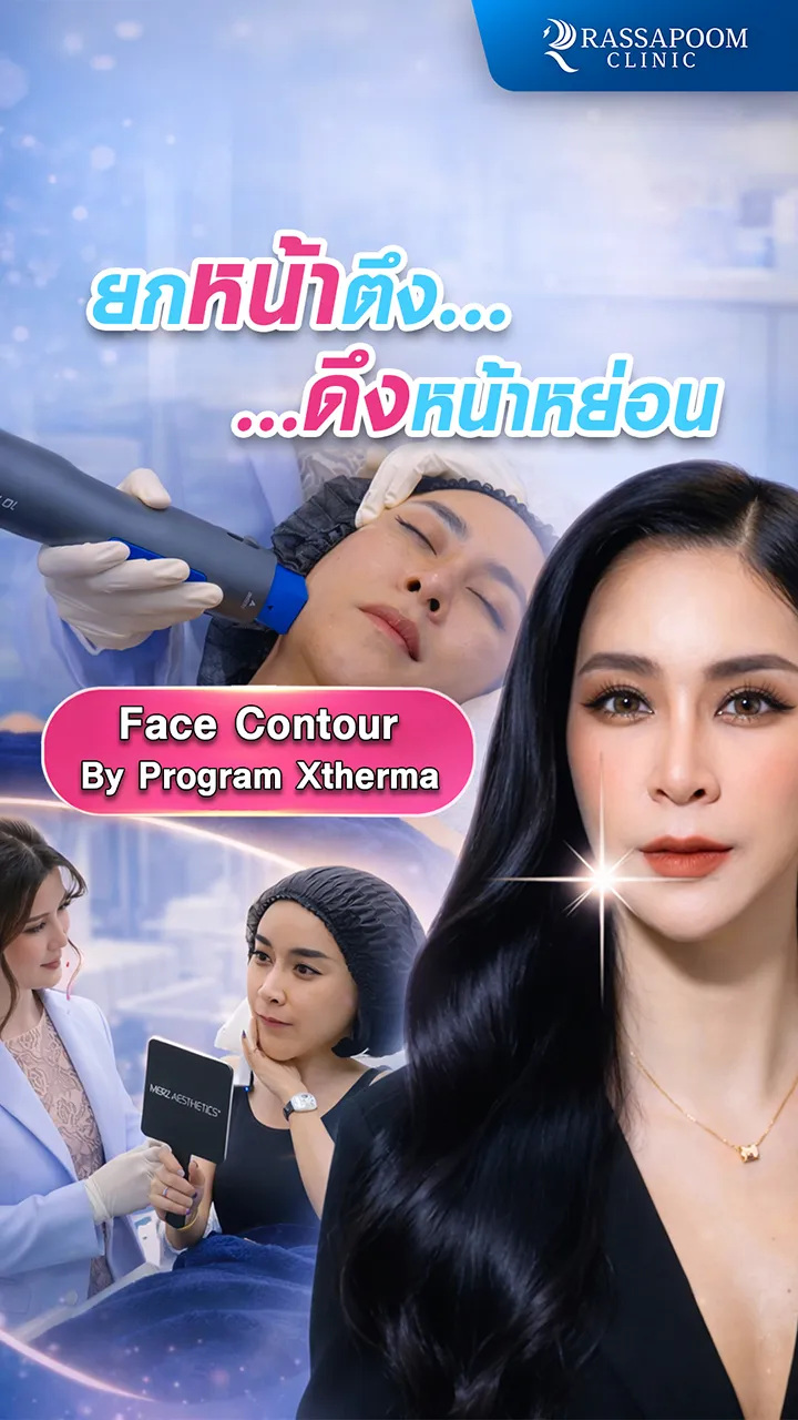 ยกหน้า ยุบแฟต สวยด่วนแบบติด Speed ฉบับ (คุณใหม่ สุคนธวา)