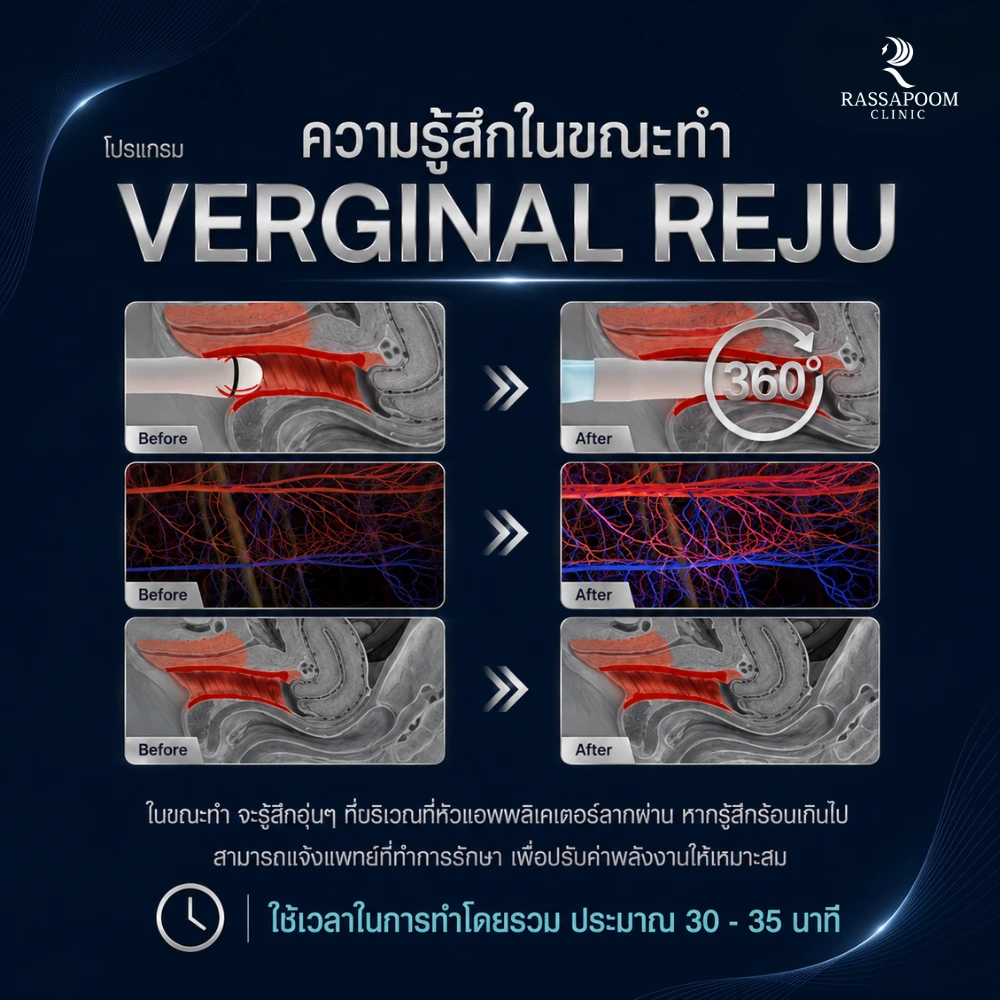 ความรู้สึกขณะทำ โปรแกรม Vaginal Reju
