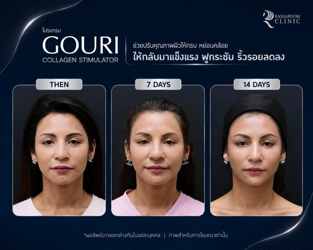 รวมผลลัพธ์หลังทำโปรแกรม Gouri (3)