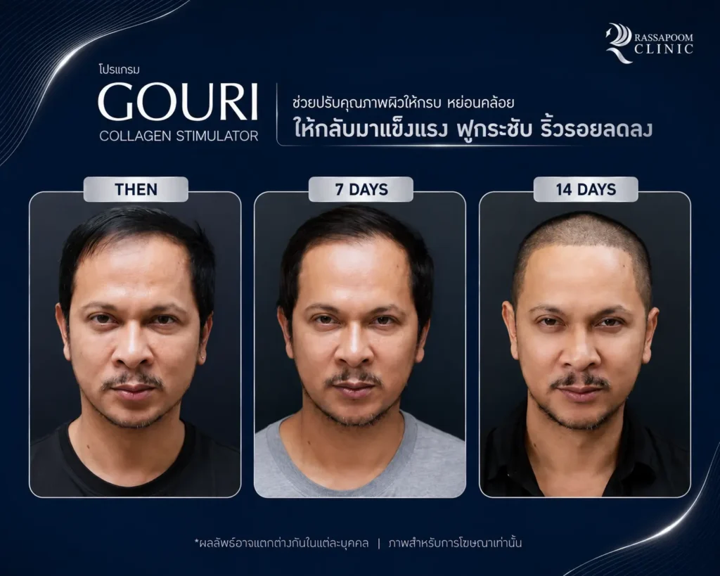 รวมผลลัพธ์หลังทำโปรแกรม Gouri (4)