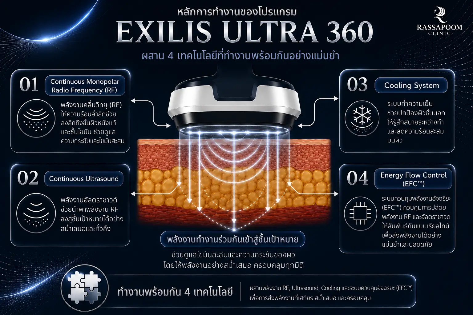 หลักการทำงานของโปรแกรม EXILIS ULTRA 360