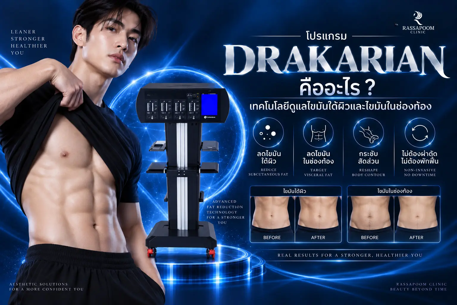 โปรแกรม DRAKARIAN เทคโนโลยีดูแลไขมันใต้ผิวและไขมันในช่องท้อง