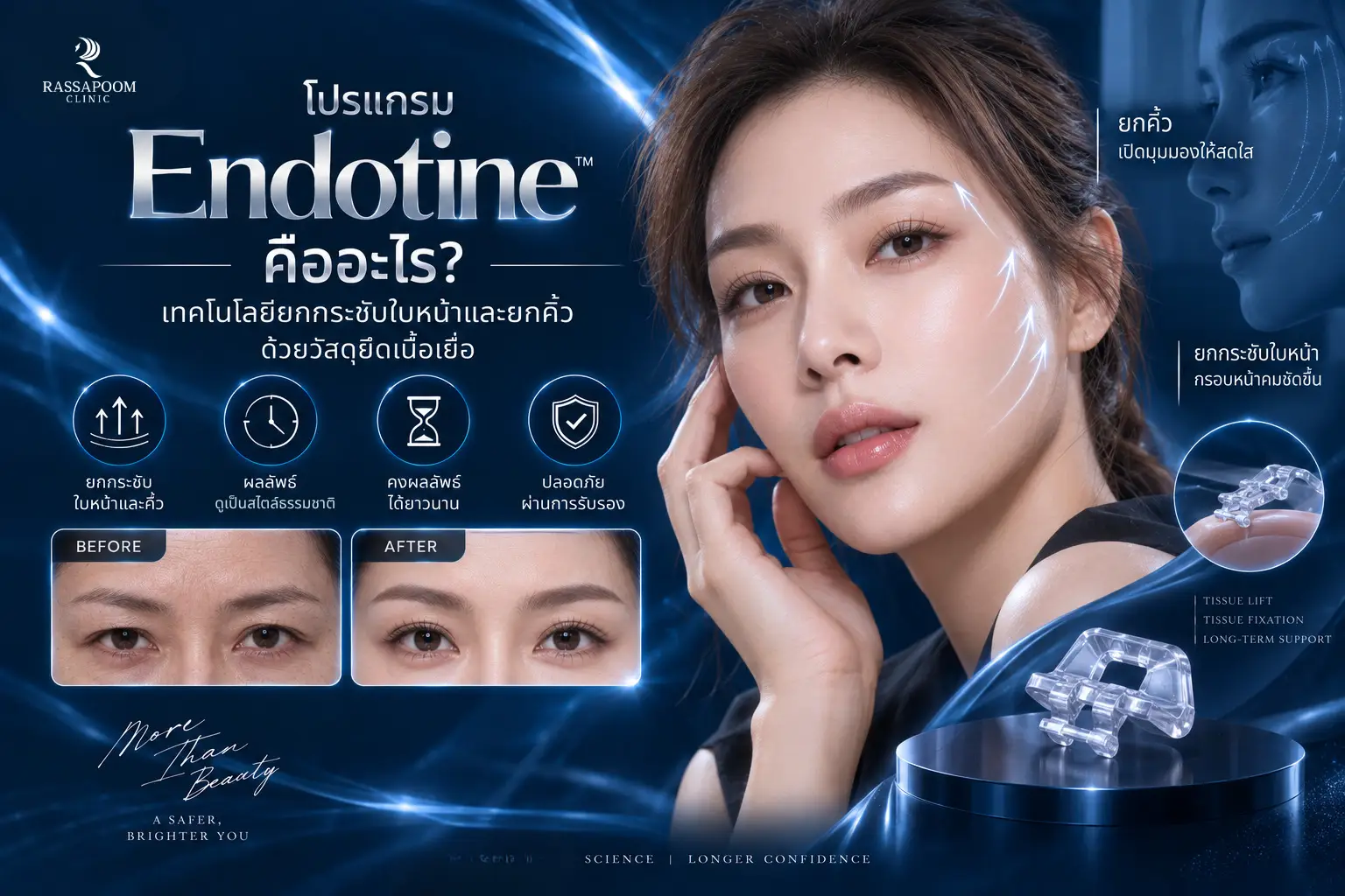 โปรแกรม Endotine คืออะไร เทคโนโลยียกกระชับใบหน้าและยกคิ้วด้วยวัสดุยึดเนื้อเยื่อ