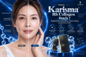 โปรแกรม Karisma Rh Collagen คืออะไร ฟื้นฟูผิวที่เริ่มหย่อนคล้อย