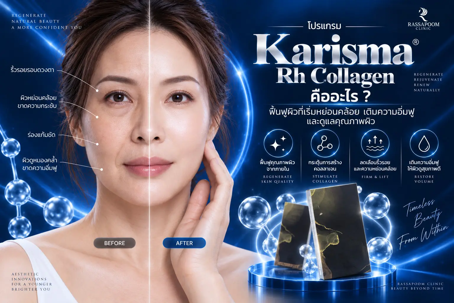 โปรแกรม Karisma Rh Collagen คืออะไร ฟื้นฟูผิวที่เริ่มหย่อนคล้อย
