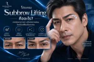 โปรแกรม Subbrow Lifting คืออะไร เทคนิคยกหางตา