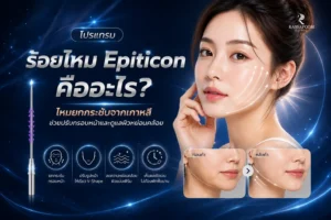 โปรแกรมร้อยไหม Epiticon คืออะไร