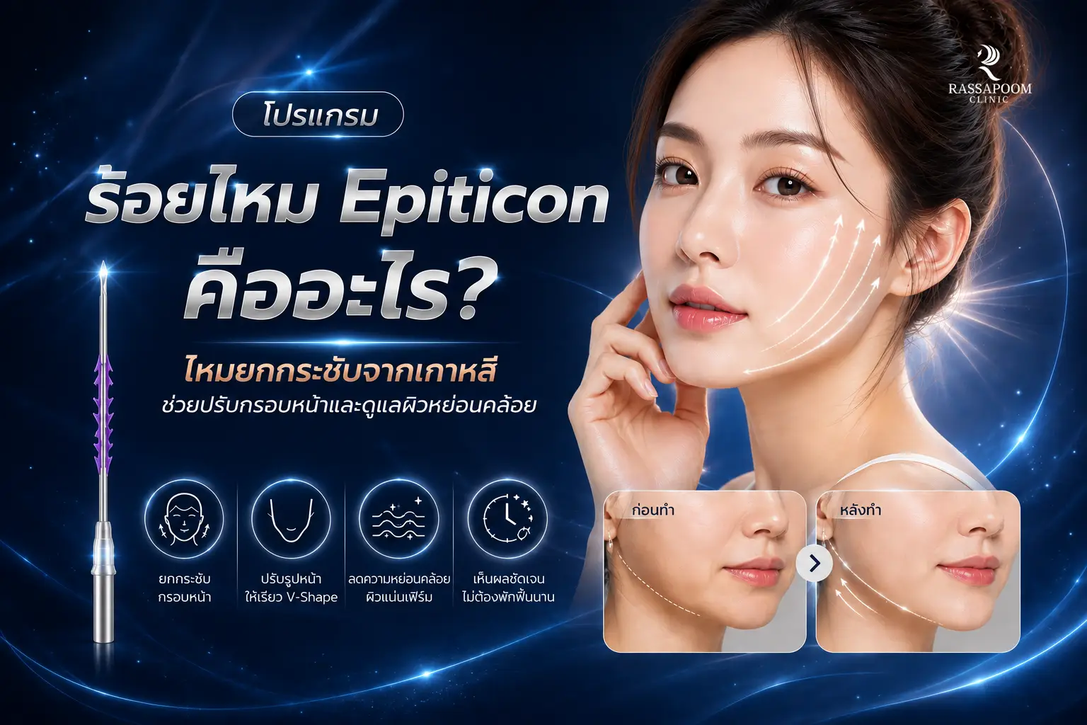โปรแกรมร้อยไหม Epiticon คืออะไร